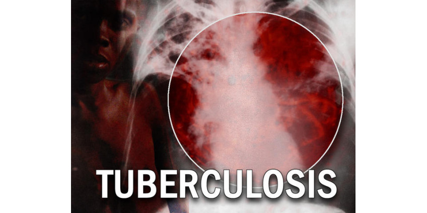 Пассажиры не смогли выйти из самолета из-за больного мужчины