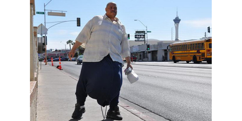 Скончался обладатель самой большой в мире мошонки