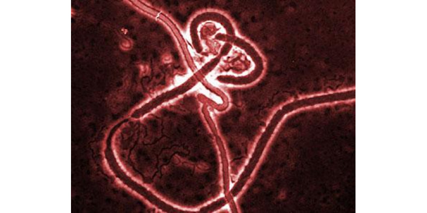 Лихорадки Эбола в Калифорнии нет