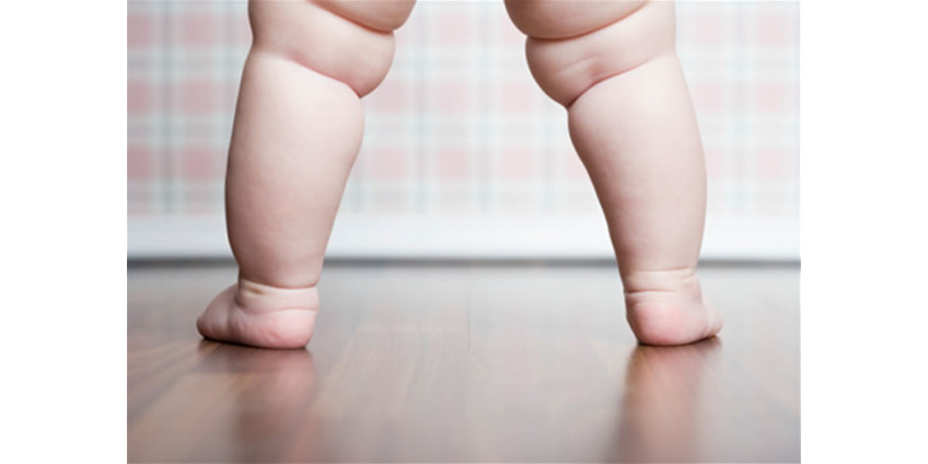 В Сан-Диего предлагают новый метод борьбы с ожирением