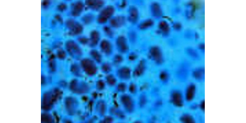 В Неваду проникла супербактерия