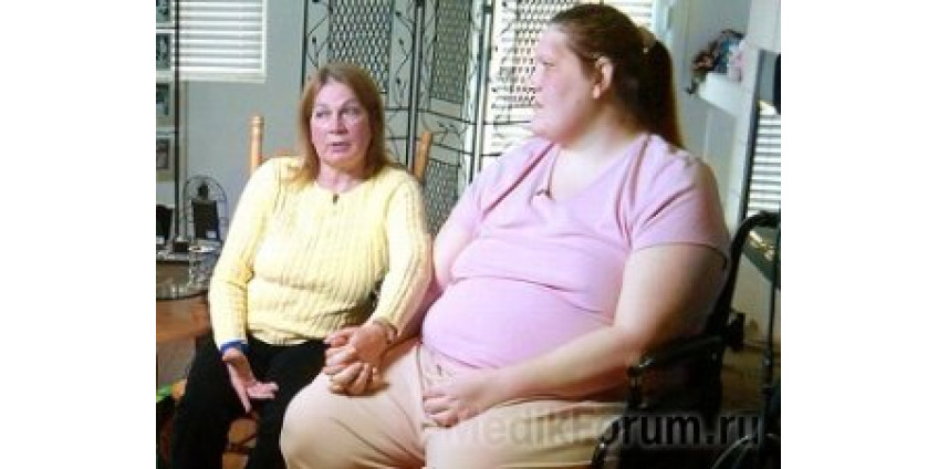 Жительница Невады умирает от акромегалии