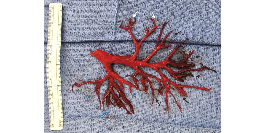 Медики из Сан-Диего стали свидетелями редкого медицинского случая