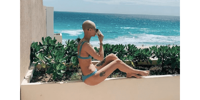 Лас-Вегас: у девушки выявили рак лишь после четвертого обращения к врачу с жалобами