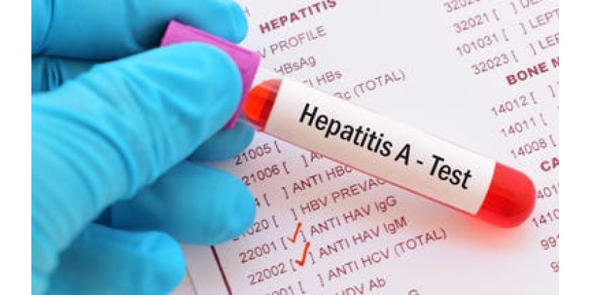 Вспышка гепатита А в Аризоне: власти сообщили о двух смертях Вспышка гепатита А в Аризоне: власти сообщили о двух смертях