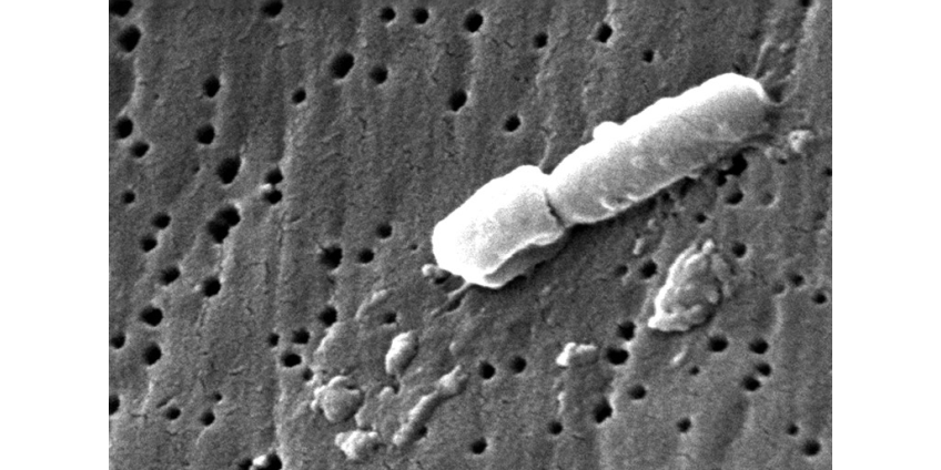 Ученые рассказали, откуда ждать следующего нашествия "супербактерий"