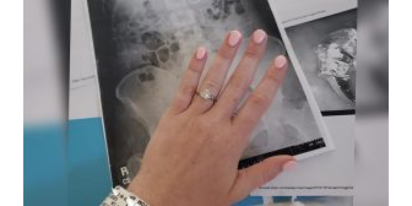 Жительница Сан-Диего съела обручальное кольцо, спасаясь от вымышленных преступников