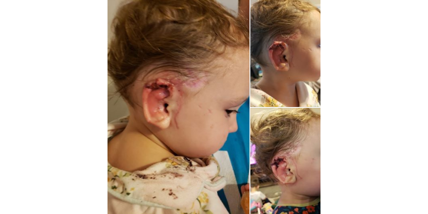 Мать в ужасе смотрела, как на 15-месячную малышку набросился огромный немецкий дог и откусил кусочек уха