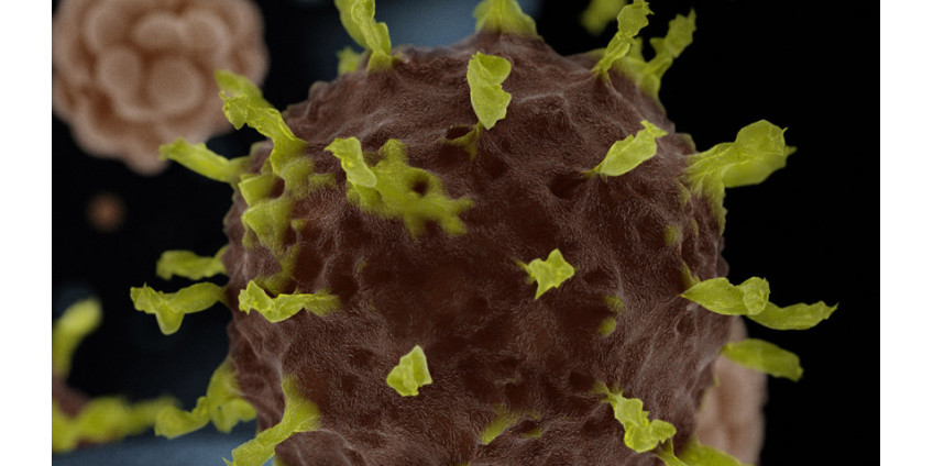В Западном Лос-Анджелесе подтвержден новый случай заболевания коронавирусом