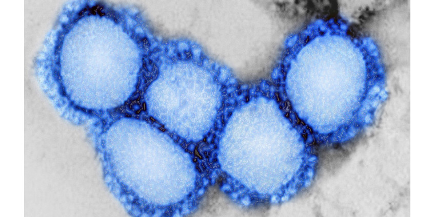 Вспышка коронавируса в Лос-Анджелесе привела к закрытию некоторых учебных заведений и отмене ряда мероприятий