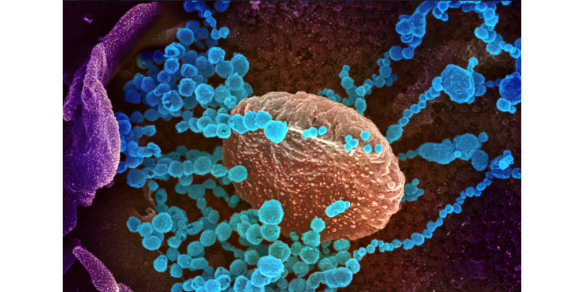 Вакцины, целебные отвары, антитела: как пытаются лечить новый коронавирус COVID-19