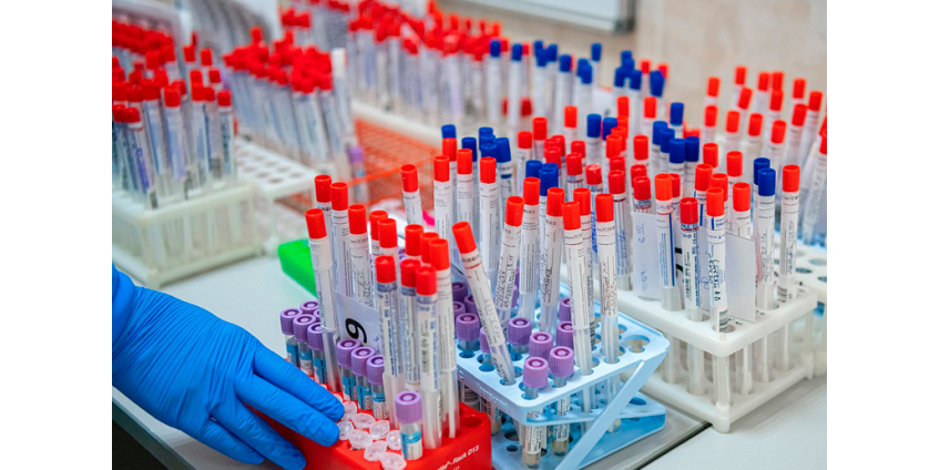 Глава Роспотребнадзора рассказала о росте числа бессимптомных случаев заболевания коронавирусом в России