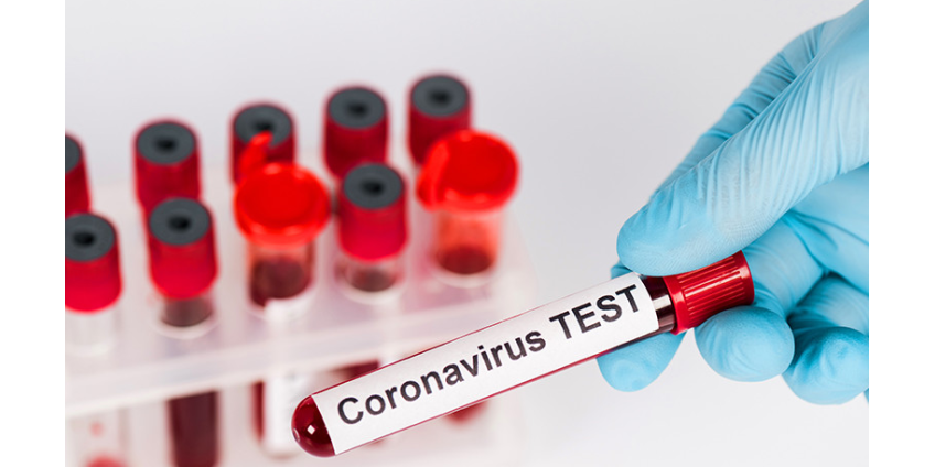 После первой волны пандемии коронавируса в мире могут ввести "иммунные паспорта" для пересечения границ