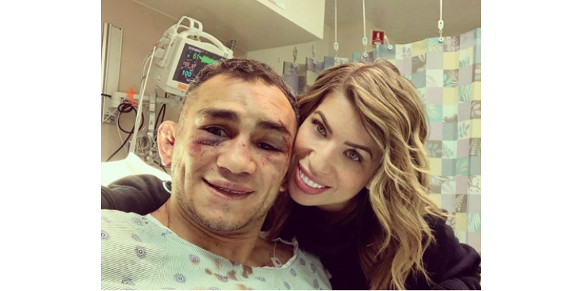 Тони Фергюсон в бою с Джастином Гэтжи получил перелом орбитальной кости лица