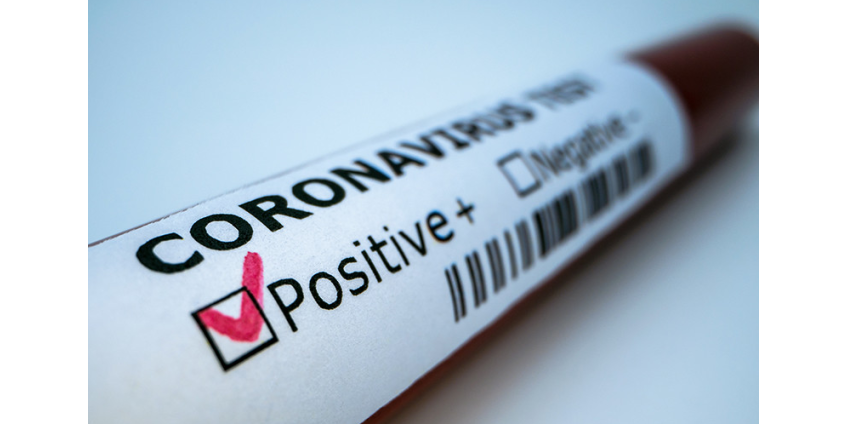 В США у более сотни детей коронавирус вызвал опасный воспалительный синдром