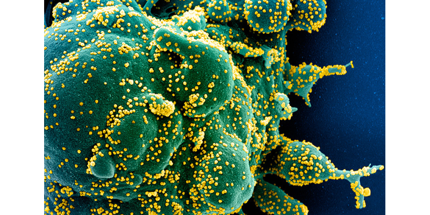 Более 60 государств поддержали предложение властей Австралии о проведении независимого расследования появления COVID-19