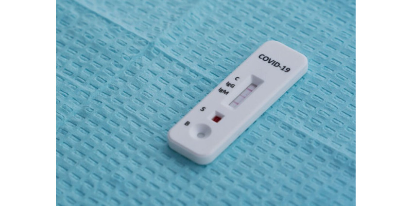 В Лос-Анджелесе коронавирусом переболели 4,6% взрослых