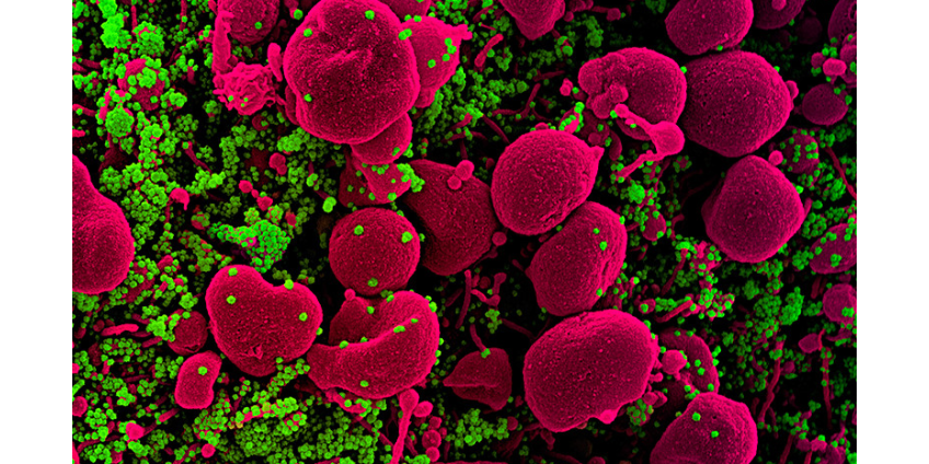 Одну из российских вакцин против COVID-19 можно будет закапать в нос