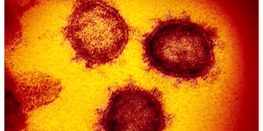 Власти обеспокоены всплеском случаев COVID-19 в округе Лос-Анджелес