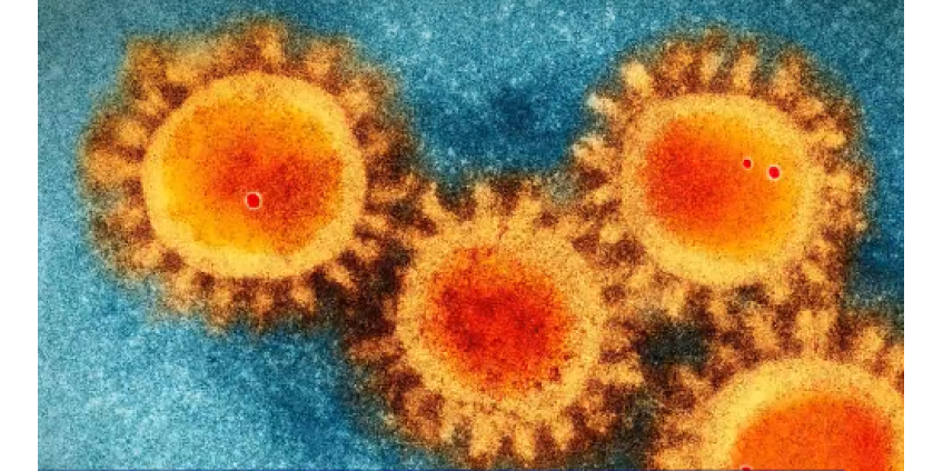 В Лос-Анджелесе зарегистрировано новое рекордное количество случаев заражения коронавирусом