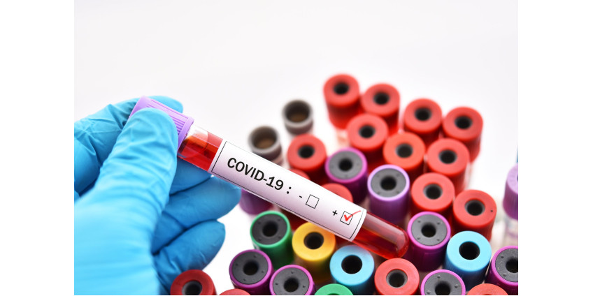 Округ Лос-Анджелес сообщает о 3628 новых случаях COVID-19; 76% новых случаев заболевания у людей в возрасте до 50 лет