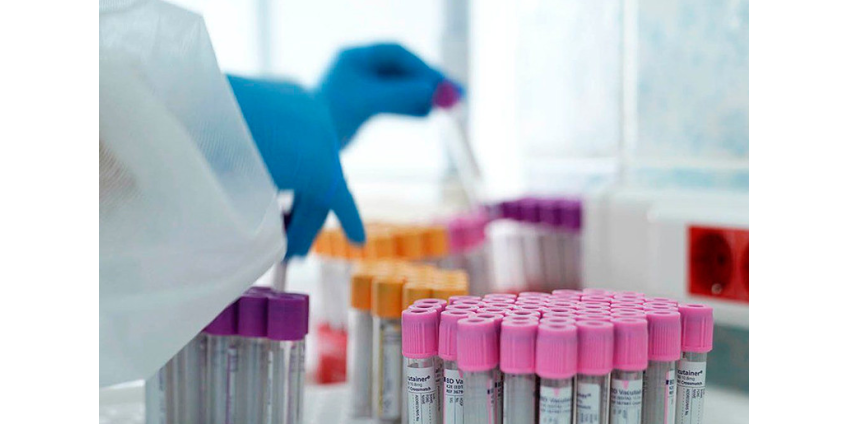 Число выявленных случаев коронавируса в России превысило 900 тысяч