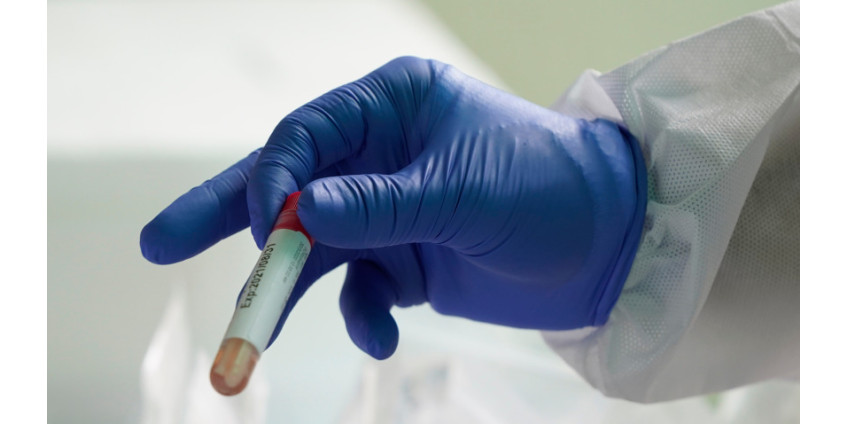 В Сан-Диего зарегистрировано 236 новых случаев COVID-19