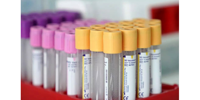 В РФ новые случаи коронавируса второй день подряд отмечаются во всех регионах