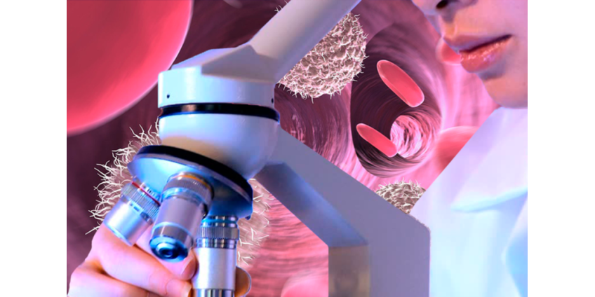 Магнитные наночастицы помогут победить самый агрессивный рак