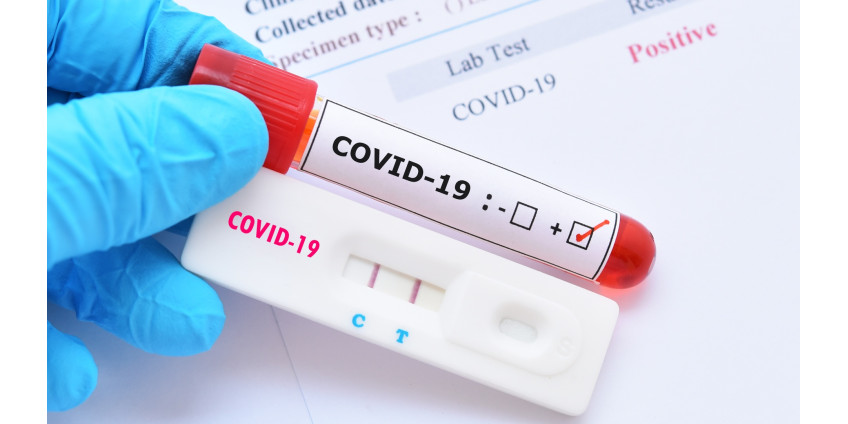 В округе Лос-Анджелес каждые 6 минут фиксируется одна смерть от коронавируса