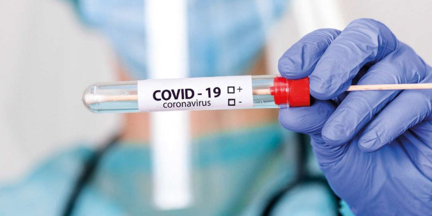 В Аризоне настоятельно рекомендуют делать больше тестов, поскольку новые случаи COVID-19 продолжают фиксироваться