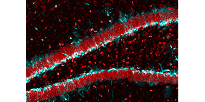 Исследователи поняли, как обновить головной мозг