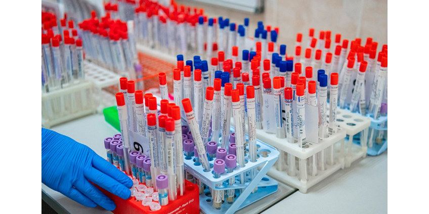 В России в середине весны ожидается рост заболеваемости COVID-19