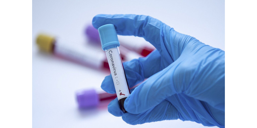 Округ Лос Анджелес сообщает о 1827 новых случаях заражения COVID-19. Власти вновь вводят масочный режим