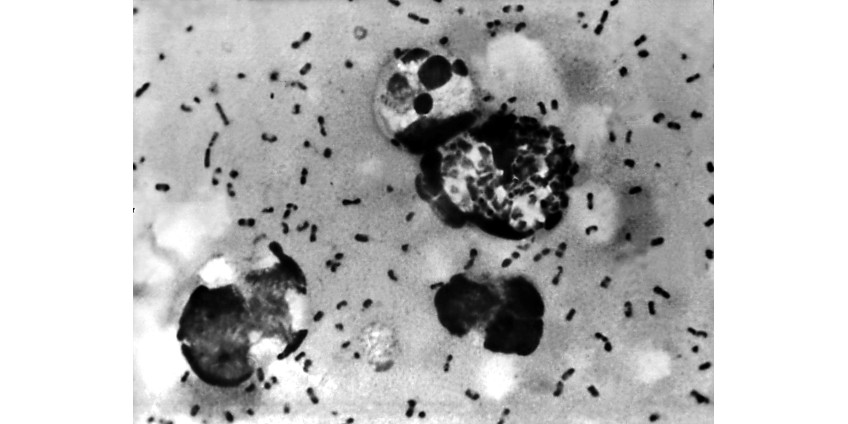 В штате Колорадо выявили чуму