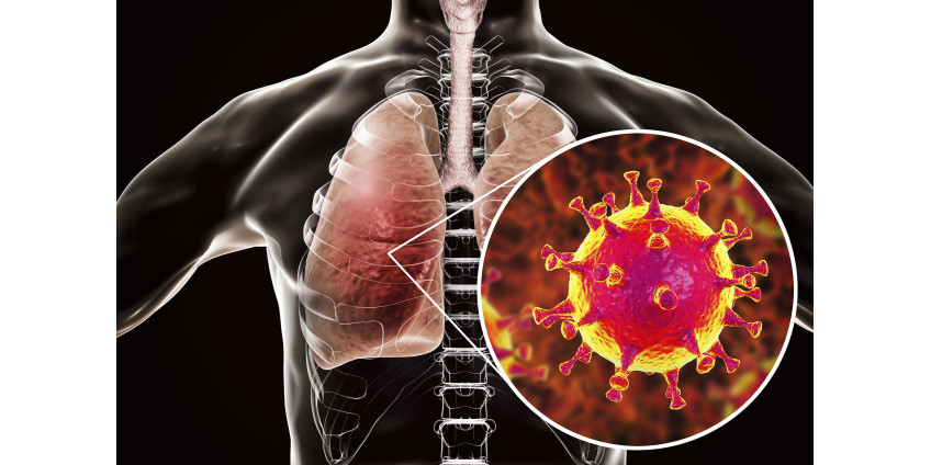 Округ Сан-Диего сообщает о самом высоком ежедневном количестве случаев заболевания COVID-19 с января