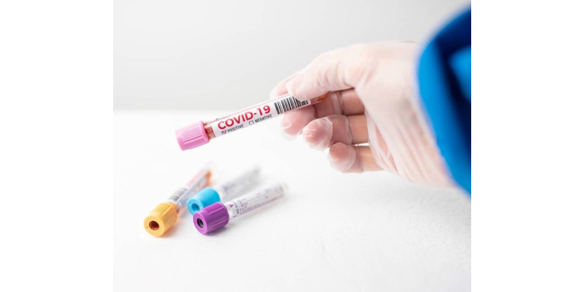 В Госдуме предложили тестировать россиян на коронавирус каждую неделю