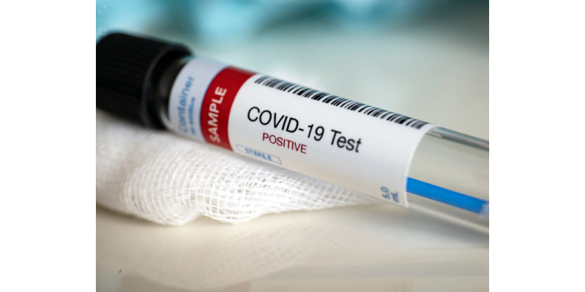 Рост случаев COVID-19 за границей может быть зловещим предвестником для Сан-Диего