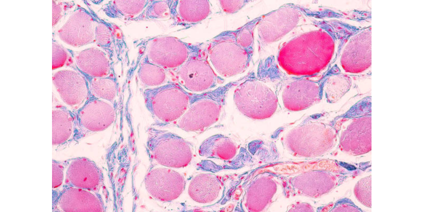 Найден способ омоложения клеток