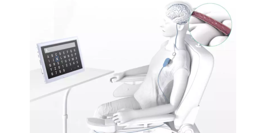 В США начались испытания чипов для вживления в человеческий мозг