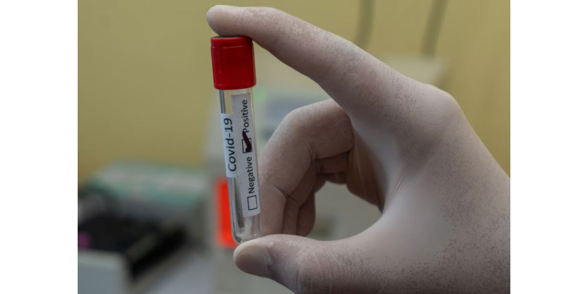 Число госпитализаций из-за COVID в округе Лос-Анджелес превысило 900