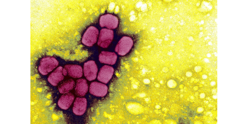 Округ Сан-Диего объявляет чрезвычайную ситуацию в области общественного здравоохранения из-за оспы обезьян