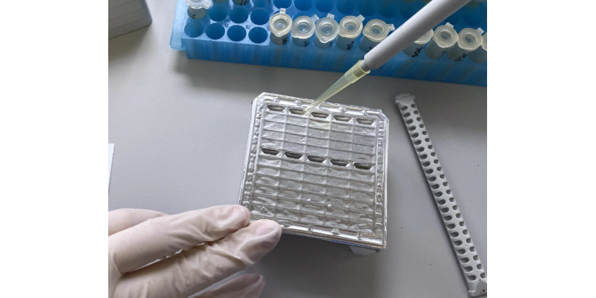 Оспу обезьян снова выявили в Санкт-Петербурге Оспу обезьян снова выявили в Санкт-Петербурге