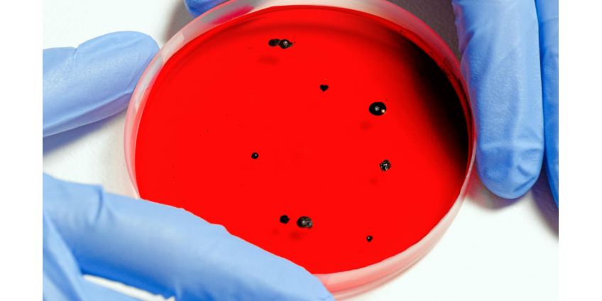 В Роспотребнадзоре прокомментировали риск завоза африканского заболевания В Роспотребнадзоре прокомментировали риск завоза африканского заболевания