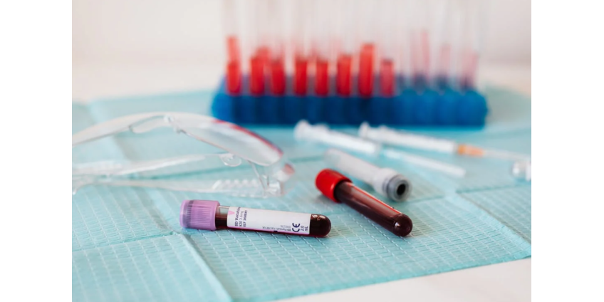 У работника Beverly Hills Whole Foods выявлен положительный результат теста на гепатит А