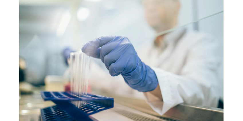 В округе Лос-Анджелес зафиксирован рост числа случаев эндемического тифа.